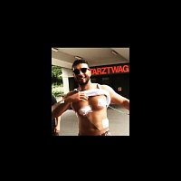 OMAR – STICHNARBEN 2