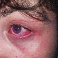 Přední strana obalu CD kan burundu