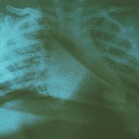 Přední strana obalu CD Chew It All