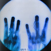 SWIDT – WHO R U